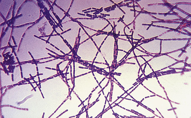 Dealing with anthrax Dealing with anthrax