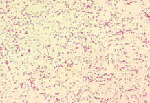 Protect your cattle against brucellosis