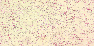 Protect your cattle against brucellosis