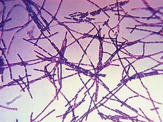 About anthrax About anthrax