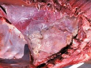 Pneumonic (lung) pasteurellosis in cattle