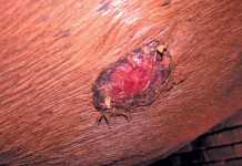 Dealing-with-equine-sarcoids