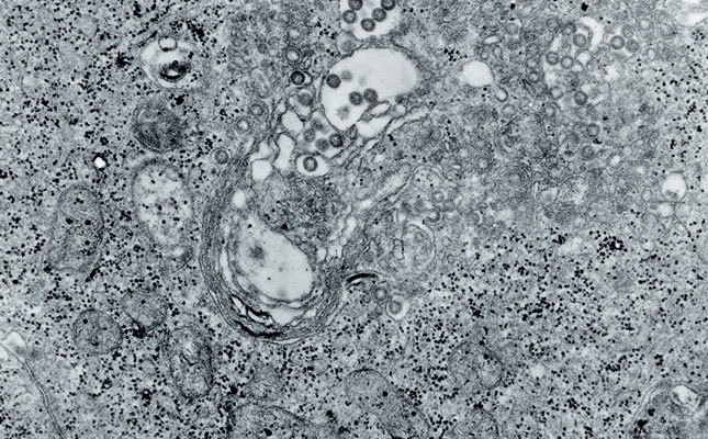 Rift Valley Fever in sheep and goats Rift Valley Fever in sheep and goats