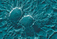 Bacterial cells of Staphylococcus aureus,