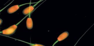 cryopreserveed sperm cells